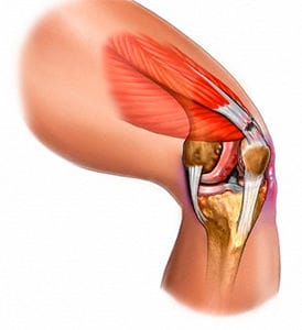 como curar una lesion